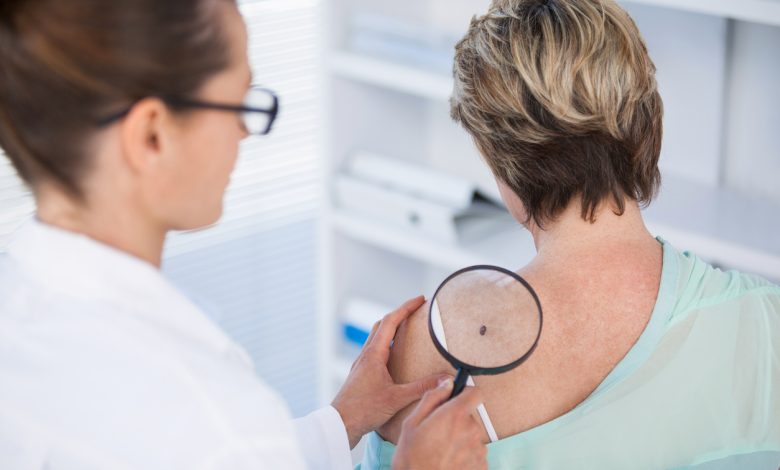 How To Pick The Best Skin Cancer Clinic or GP